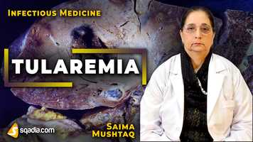 Free download Tularemia | Disease Management | Medicine Video Lectures | Medical Student | V-Learning video and edit with RedcoolMedia movie maker MovieStudio video editor online and AudioStudio audio editor onlin