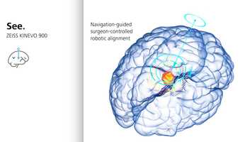 Free download Tumor-workflow-animation-digital-devices-EN-30-160-0314I video and edit with RedcoolMedia movie maker MovieStudio video editor online and AudioStudio audio editor onlin