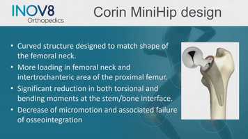 Free download WED-GRAND3-073 - Evolving Technique- Microplasty Stems- Need To Understand Who You Use Them In  How To Get The Results Stefan K video and edit with RedcoolMedia movie maker MovieStudio video editor online and AudioStudio audio editor onlin