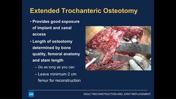 Free download WED-GRAND3-091 - Evolving Technique Update- Metallosis, Trunnionosis- How To Diagnose, How To Manage, How To Look Good H John Co video and edit with RedcoolMedia movie maker MovieStudio video editor online and AudioStudio audio editor onlin