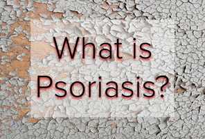 Free download What is Psoriasis? video and edit with RedcoolMedia movie maker MovieStudio video editor online and AudioStudio audio editor onlin
