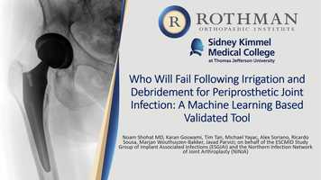 Free download Who Will Fail Following Irrigation and Debridement for Periprosthetic Joint Infection: A Machine Learning Based Validated Tool video and edit with RedcoolMedia movie maker MovieStudio video editor online and AudioStudio audio editor onlin