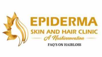 Free download Why is my hair getting thinner | Epiderma Skin and Hair Clinic in Jayanagar, Bangalore video and edit with RedcoolMedia movie maker MovieStudio video editor online and AudioStudio audio editor onlin