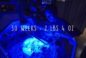 Free download 30 Weeks  2 lbs 4 ounces video and edit with RedcoolMedia movie maker MovieStudio video editor online and AudioStudio audio editor onlin