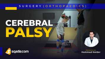 Free download Cerebral Palsy | Orthopedic Surgery Lectures | Medical Online Education | V-Learning video and edit with RedcoolMedia movie maker MovieStudio video editor online and AudioStudio audio editor onlin