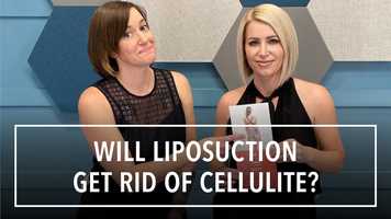 Free download Does Liposuction Help With Cellulite? video and edit with RedcoolMedia movie maker MovieStudio video editor online and AudioStudio audio editor onlin