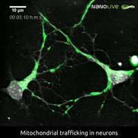 Free download Mitochondrial trafficking in neurons video and edit with RedcoolMedia movie maker MovieStudio video editor online and AudioStudio audio editor onlin