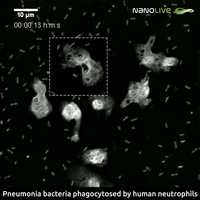 Free download Pneumonia bacteria phagocyted by neutrophils video and edit with RedcoolMedia movie maker MovieStudio video editor online and AudioStudio audio editor onlin