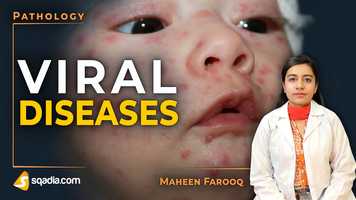 Free download Viral Diseases | Smallpox | Pathology Video | Medical Education Channel | V-Learning video and edit with RedcoolMedia movie maker MovieStudio video editor online and AudioStudio audio editor onlin