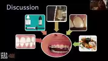 Free download 2725 Mrs. Warni Eka Muthia Anwar In-Office Teeth Whitening Technique Post Orthodontic Treatment: A Case Report. video and edit with RedcoolMedia movie maker MovieStudio video editor online and AudioStudio audio editor onlin