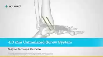 Free download 4.0 mm Cannulated Screw System Surgical Technique Overview Animation video and edit with RedcoolMedia movie maker MovieStudio video editor online and AudioStudio audio editor onlin