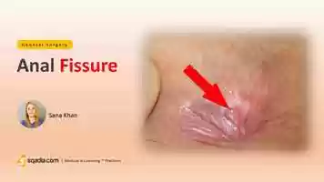Free download Anal Fissure | Surgery Video Lectures | Medical Education | V-Learning | sqadia.com video and edit with RedcoolMedia movie maker MovieStudio video editor online and AudioStudio audio editor onlin
