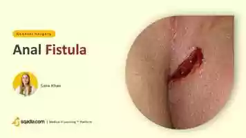 Free download Anal Fistula | Surgery Online Video Lectures | Medical Student | V-Learning | sqadia.com video and edit with RedcoolMedia movie maker MovieStudio video editor online and AudioStudio audio editor onlin