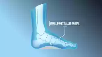 Free download Animation-AnatomicalFoot_12s_Wide_SoulInsole video and edit with RedcoolMedia movie maker MovieStudio video editor online and AudioStudio audio editor onlin