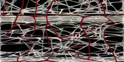 Free download ANIMATION GLOBAL TRAVELLING CORONAL PLURITISSULAR FIBRILLAR NETWORK ARCHITECTURE 2 video and edit with RedcoolMedia movie maker MovieStudio video editor online and AudioStudio audio editor onlin