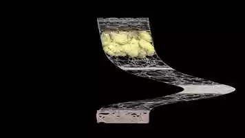 Free download ANIMATION TENDON GLIDING ABSORBING SYSTEM CONTINUITY MOVEMENT video and edit with RedcoolMedia movie maker MovieStudio video editor online and AudioStudio audio editor onlin