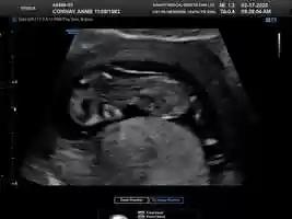 Free download baby movie video and edit with RedcoolMedia movie maker MovieStudio video editor online and AudioStudio audio editor onlin