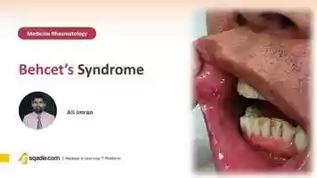 Free download Behcets Syndrome | Rheumatology Medicine Video Lectures | Medical Student | V-Learning video and edit with RedcoolMedia movie maker MovieStudio video editor online and AudioStudio audio editor onlin
