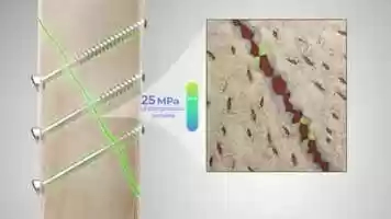 Free download BMG Bone Intimate Alignment Animation video and edit with RedcoolMedia movie maker MovieStudio video editor online and AudioStudio audio editor onlin