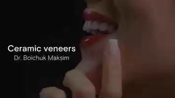 Free download Ceramic Veneers Dentist Showcase video and edit with RedcoolMedia movie maker MovieStudio video editor online and AudioStudio audio editor onlin