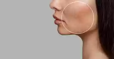 Free download CO2 GAAS Laser Skin Resurfacing video and edit with RedcoolMedia movie maker MovieStudio video editor online and AudioStudio audio editor onlin