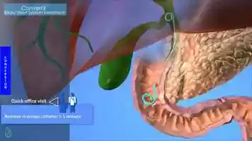 Free download ConvertX Biliary Animation video and edit with RedcoolMedia movie maker MovieStudio video editor online and AudioStudio audio editor onlin
