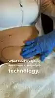 Free download CoolSculpting - How Does CoolSculpting Work? - Skin Vitality video and edit with RedcoolMedia movie maker MovieStudio video editor online and AudioStudio audio editor onlin