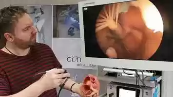 Free download DePuy OP Kamera - Funktionsmodell video and edit with RedcoolMedia movie maker MovieStudio video editor online and AudioStudio audio editor onlin