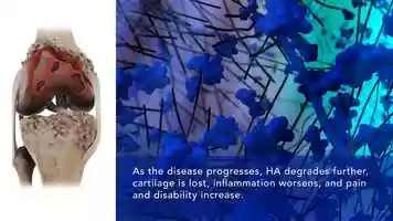 Free download Deterioration of Hyaluronic Acid in Knee Joint video and edit with RedcoolMedia movie maker MovieStudio video editor online and AudioStudio audio editor onlin