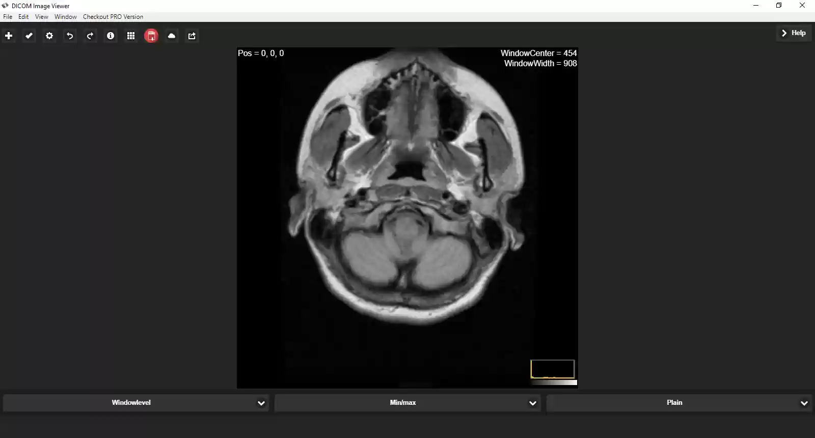 Download web tool or web app DICOM Image Reader Download web tool or web app DICOM Image Reader