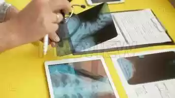 Free download Doctor Examines X-Ray Stock Video video and edit with RedcoolMedia movie maker MovieStudio video editor online and AudioStudio audio editor onlin