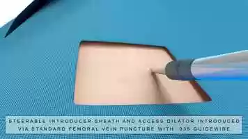 Free download East End Medical - SafeCross Product Animation Final video and edit with RedcoolMedia movie maker MovieStudio video editor online and AudioStudio audio editor onlin