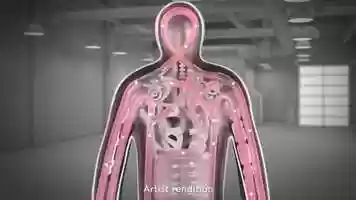 Free download Entyvio_Patient_Mode of Action animation video and edit with RedcoolMedia movie maker MovieStudio video editor online and AudioStudio audio editor onlin