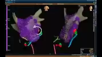 Free download figure 4_movie video and edit with RedcoolMedia movie maker MovieStudio video editor online and AudioStudio audio editor onlin