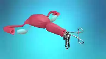 Free download Foley Balloon Animation video and edit with RedcoolMedia movie maker MovieStudio video editor online and AudioStudio audio editor onlin