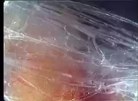 Free download FOREARM FIBER FIBRILLAR NETWORK GLIDING SYSTEM MOVEMENT  MAGNIFICATION FRACTALISATION NONHD 20090624 16.04.02.mov video and edit with RedcoolMedia movie maker MovieStudio video editor online and AudioStudio audio editor onlin