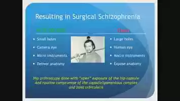 Free download FRI-Grand3-407-Evolving Technique Update- Capsular Reconstruction- You Need To Know How - Why Would I Ever Do That- video and edit with RedcoolMedia movie maker MovieStudio video editor online and AudioStudio audio editor onlin