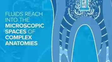 Free download GentleWave Mechanism of Action video and edit with RedcoolMedia movie maker MovieStudio video editor online and AudioStudio audio editor onlin