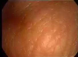 Free download HAND SKIN SURFACE POLYEDRON MOVEMENT NONHD 20050609 15.19.29.mov video and edit with RedcoolMedia movie maker MovieStudio video editor online and AudioStudio audio editor onlin