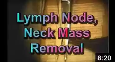 Free download How to safely remove a neck mass, lymph node. video and edit with RedcoolMedia movie maker MovieStudio video editor online and AudioStudio audio editor onlin