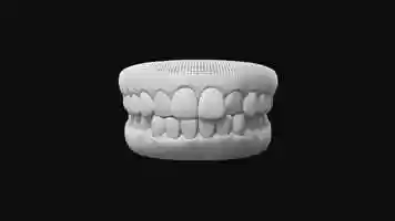 Free download Invisalign Clear Aligners Treatment | Clinique Chloe video and edit with RedcoolMedia movie maker MovieStudio video editor online and AudioStudio audio editor onlin