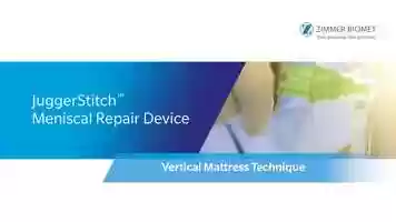 Free download JuggerStitch Vertical Mattress Technique Video video and edit with RedcoolMedia movie maker MovieStudio video editor online and AudioStudio audio editor onlin
