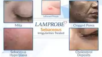 Free download Lamprobe in Action video and edit with RedcoolMedia movie maker MovieStudio video editor online and AudioStudio audio editor onlin