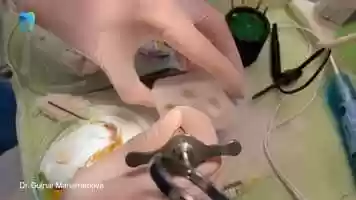 Free download MAP System in action during the microscopic endodontic course. video and edit with RedcoolMedia movie maker MovieStudio video editor online and AudioStudio audio editor onlin