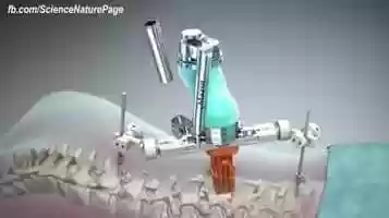 Free download Mazor Robotics - Surgical Robotics video and edit with RedcoolMedia movie maker MovieStudio video editor online and AudioStudio audio editor onlin