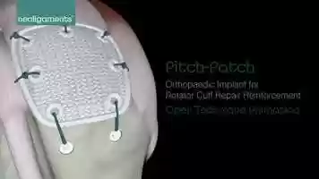Free download Pitch-Patch Open Technique video and edit with RedcoolMedia movie maker MovieStudio video editor online and AudioStudio audio editor onlin