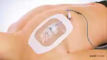 Free download PixelDeLune - Medical Art - Vygon PPS video and edit with RedcoolMedia movie maker MovieStudio video editor online and AudioStudio audio editor onlin