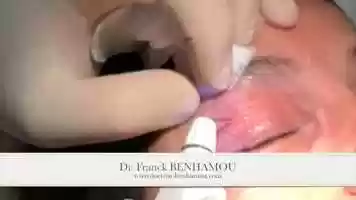 Free download plexr technique video and edit with RedcoolMedia movie maker MovieStudio video editor online and AudioStudio audio editor onlin