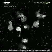 Free download Pneumonia bacteria phagocyted by neutrophils video and edit with RedcoolMedia movie maker MovieStudio video editor online and AudioStudio audio editor onlin