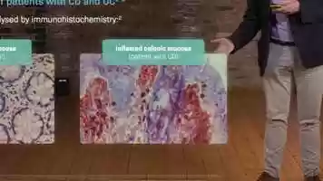 Free download Risankizumab Mode of Action_Video_PT video and edit with RedcoolMedia movie maker MovieStudio video editor online and AudioStudio audio editor onlin